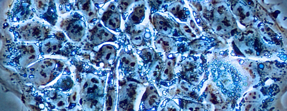Human ES cell